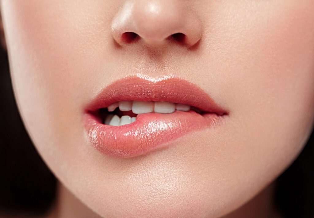 Botox®-Lip-Flip--Natürliche-Lippen-vergrößerung-Aesthetiqua-Praxis-St-Leon-Rot