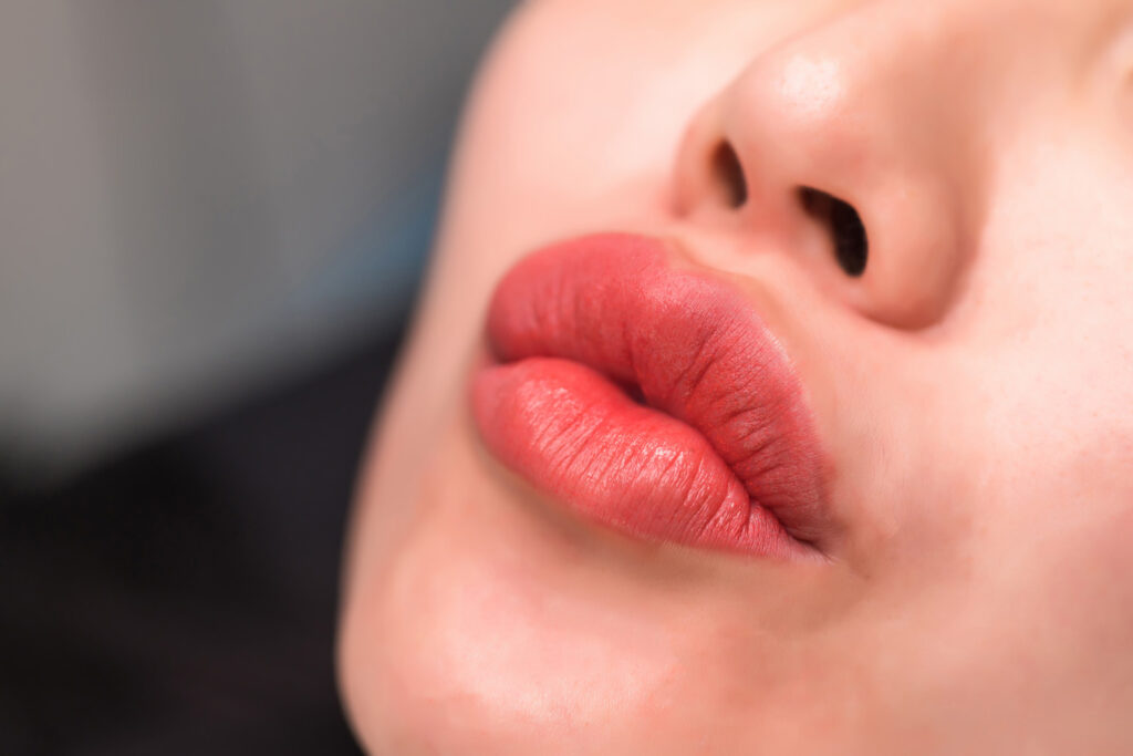 Lip Flip-Behandlung-mit-Botox-Aesthetiqua-Prais-St-Leon-Rot