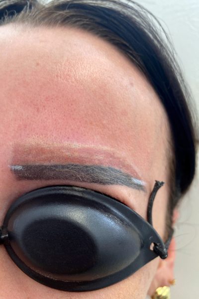 Augenbrauen Lasern Permanent Make Up entfernen Aesthetiqua