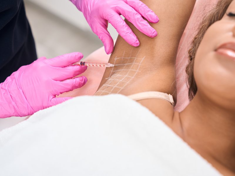 Behandlung-gegen-Schweiß-Botox®-gegen-übermäßiges-Schwitzen-Aesthetiqua