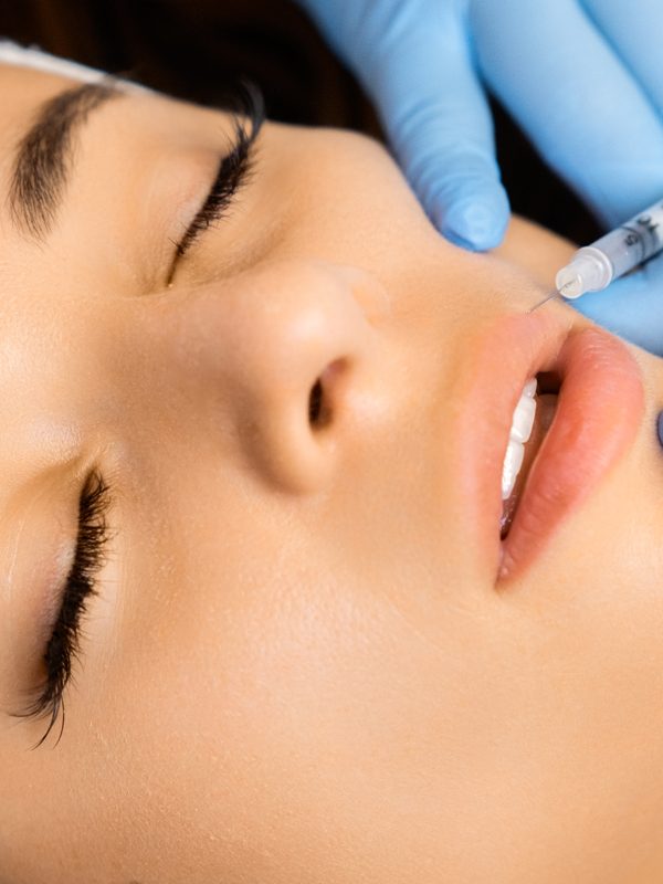 Botox-Lippen-Behandlung-Aesthetiqua-Praxis-Ärzte-