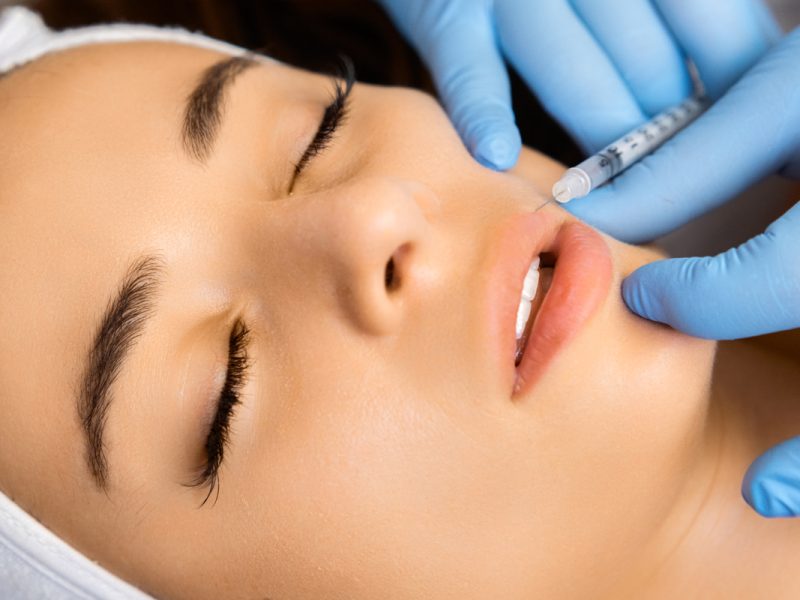 Botox-Lippen-Behandlung-Aesthetiqua-Praxis-Ärzte-