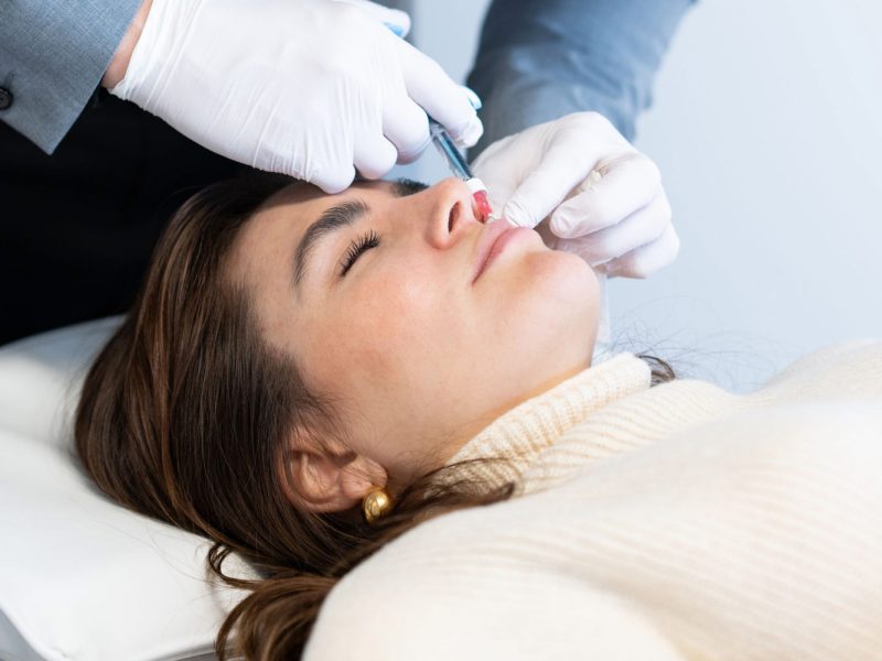 Botox-Lippen-Lippenvergrößerung-mit-Botox-Aestehtiqua