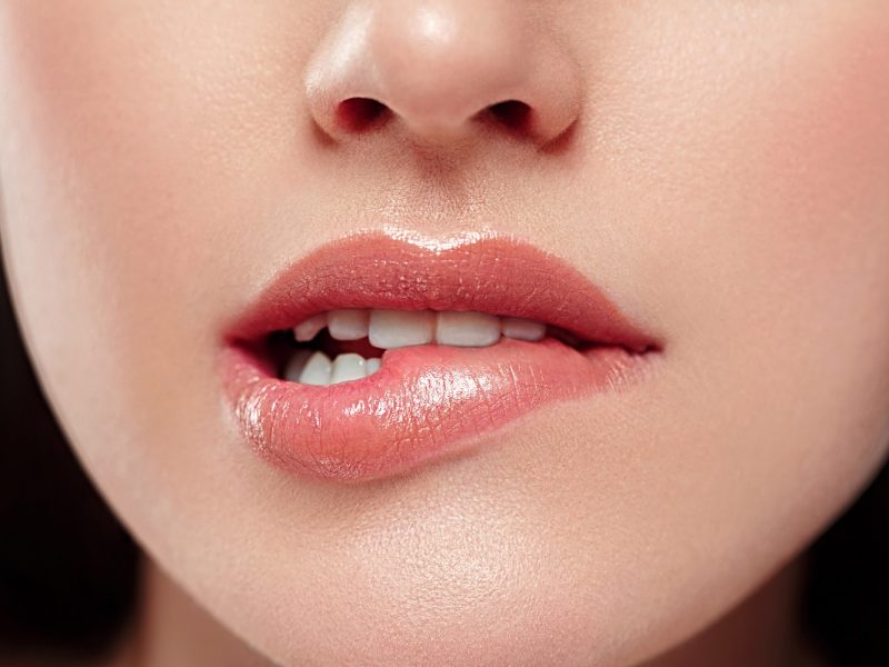 Botox®-Lip-Flip--Natürliche-Lippen-vergrößerung-Aesthetiqua-Praxis-St-Leon-Rot