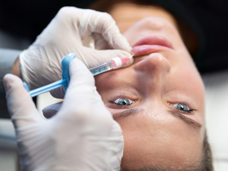 Lippen-aufspritzen-mit-Hyaluron-Behandlungsablauf-Aesthetiqua