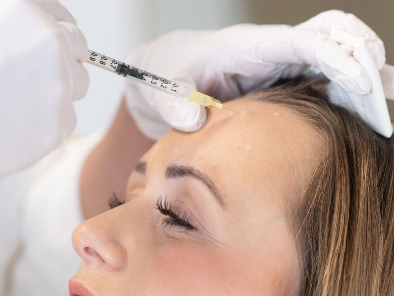 Stirn Falten entfernen Botox Aestehtiqua Behandlung