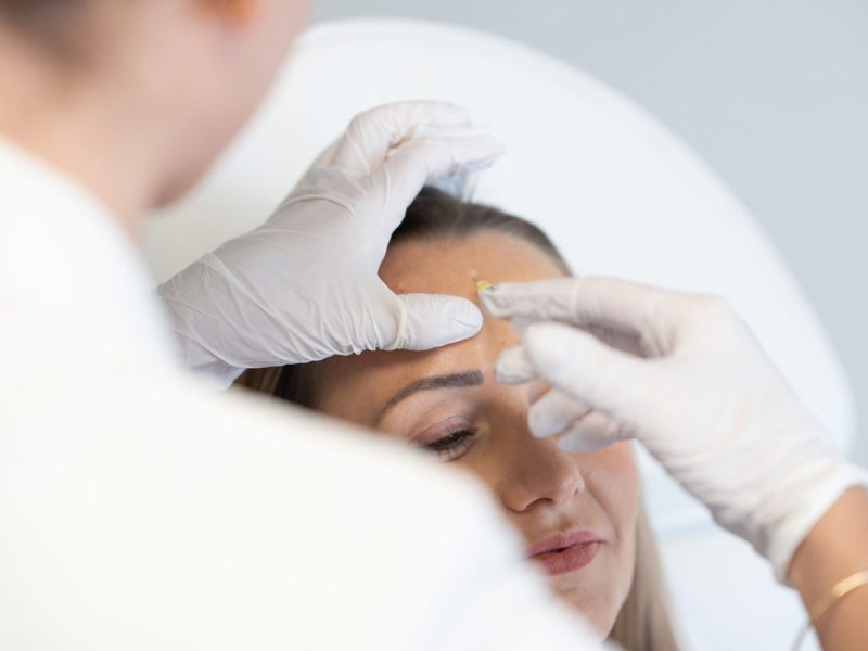 Stirnfalten-entfernen-lassen-Wirkung-Botox-Behandlung-Aesthetiqua